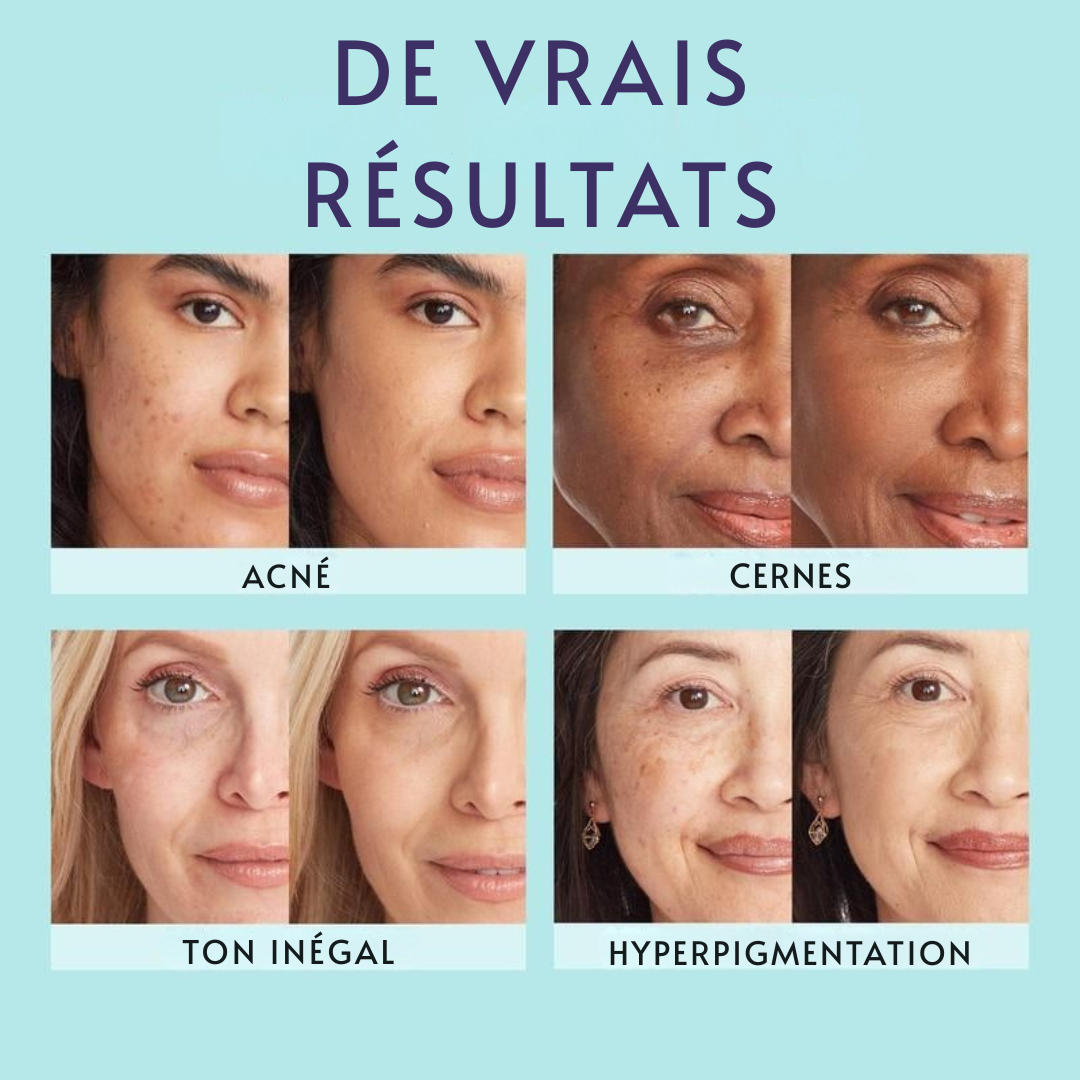 Morokos | Couvrance Beauté d'Été