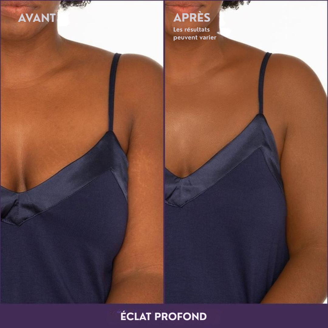 Morokos | Couvrance Beauté d'Été